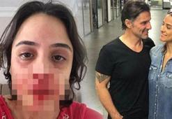 Darp olayından sonra flaş iddia!