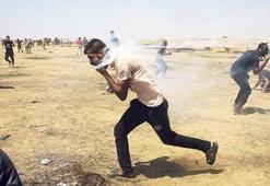 Ağzına gaz bombası isabet eden Filistinli, Gazze'den çıkmayı bekliyor