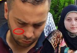 Öz amcası çıktı