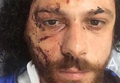 Ünlü oyuncuya şok saldırı!