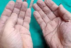 Cerrahın fotoğrafı sosyal medyayı salladı