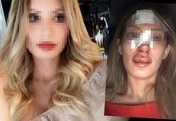 Çıplak fotoğraflı şantajın ardından darp!