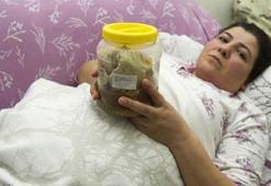 Karnında 1.8 kilo gazlı bez unutulmuştu: Hastane ve doktor suçlu çıktı