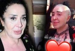 Ameliyat sonrası tanınmaz halde!