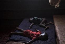 Zimbabve'de kolera salgını 32 can aldı