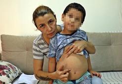 5 yaşındaki çocuğa kreşte darp iddiası