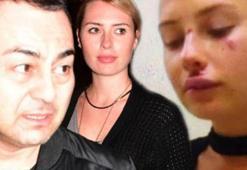Kaza sonrası ilk fotoğraf
