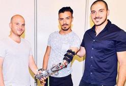 ‘Kolum varmış gibi hissediyorum’