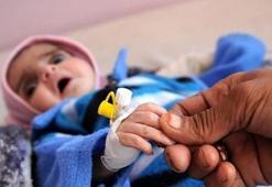 Yemen'de insanlık dramı! Her 10 dakikada 1 çocuk ölüyor