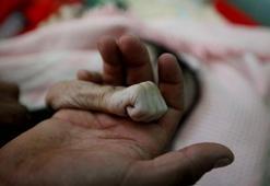 Yemen'de çocukların yüzde 80'i yardıma muhtaç!
