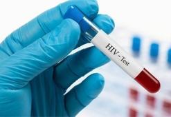 Türkiye’de HIV pozitif sayısı arttı