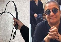 Milletvekili 'kırbaçlı' fotoğraf yayınladı!