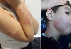 Özel rehabilitasyon merkezinde 10 yaşındaki çocuğa 'darp' iddiası