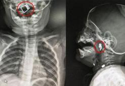 Doktor, görür görmez ameliyata aldı
