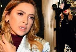 Hadise'den 'parmak' açıklaması!