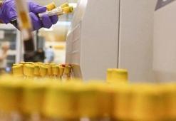 Mutfaktaki düşman: Trans yağ