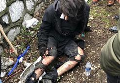 Üniversite öğrencisi köpek saldırısıyla yaralandı