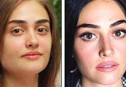 Esra Bilgiç: Estetiğe zerre kadar ihtiyacım yok!