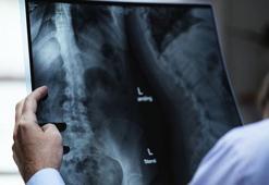 Kimler sürekli iş göremezlik maaşı alabilir?