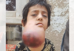 Afganistanlı küçük Habibe yardım bekliyor