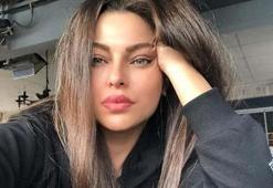 Sinem Umaş'ın kolları yandı