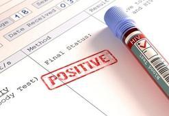 "HIV/AIDS" eğitim müfredatına girecek