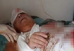 Terörist Mihraç Ural'ın patlamada yaralandığı iddia edildi