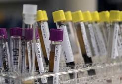 "Hepatit sebebiyle yılda 1,4 milyon kişi ölüyor"