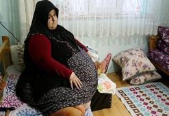 Son hali şoke etti! 1.5 yılda 155 kilo verdi