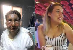 İstanbul'da vahşet: Cezaevinden izinli çıktı, eski eşini yağ ile yaktı