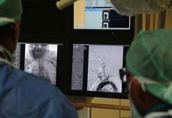 İnme en ölümcül üçüncü hastalık