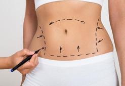 Liposuction zayıflama yöntemi değildir