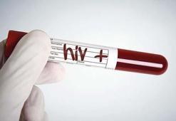 Yeni HIV türü keşfedildi