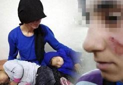 Eşinin ve 3 yaşındaki kızının yüzünü yaktı!
