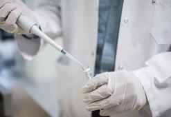 'Türkiye'de her yıl ortalama 3-4 bin kişiye AIDS tanısı konuyor'