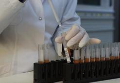 HIV düzenli ilaç kullanımıyla kontrol altında tutulabiliyor
