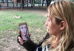 Güzellik uğruna kaybettiği alt dudağı eskisi gibi olmayacak
