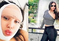 Estetik faciaları artıyor! Uzmanlar uyarıyor
