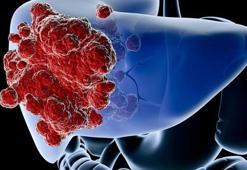 Karaciğer sağlığı için dikkat edilmesi gerekenler!