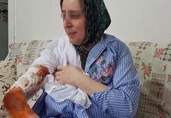 Dehşete düşüren olay! 17 yıllık eşi kaynar su ile haşladı