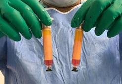 Parkinson'a erken yaşta yakalananlar dikkat!
