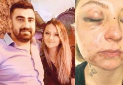 Pişkin savunma: Isırığa rızası vardı