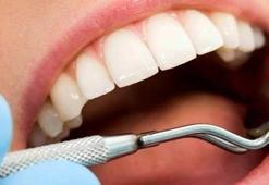 Devlet Hastanelerinde implant yapılıyor mu? SGK diş tedavisi ve implant ücretlerini karşılıyor mu? 2020 SGK diş tedavisi uygulamaları neler?
