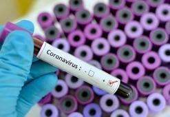 "Virüsleri engelleyemeyiz ama korunabiliriz"