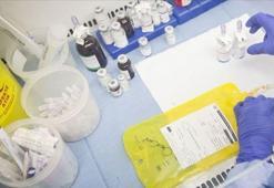 Nadir hastalıkları bulunanların sorunlarına çözüm aranıyor