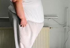 Türk Cerrahi derneklerinden obezite açıklaması