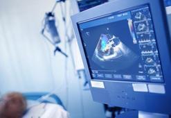 Eko Nasıl Çekilir? Nasıl Yapılır? Bebeklerde Ekogardiyografi