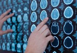 Emar nasıl çekilir? Beyin, belden ve ilaçlı mr nasıl çekilir?