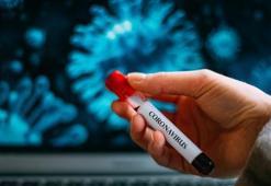 Corona virüsü testi nerede (sağlık kurumu ve il sağlık) yapılır? Test sonucu pozitif çıkarsa ne olur? Sağlık Bakanlığı Corona virüsü rehberi…