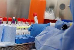 Corona virüs için flaş iddia: Aşısı bulundu